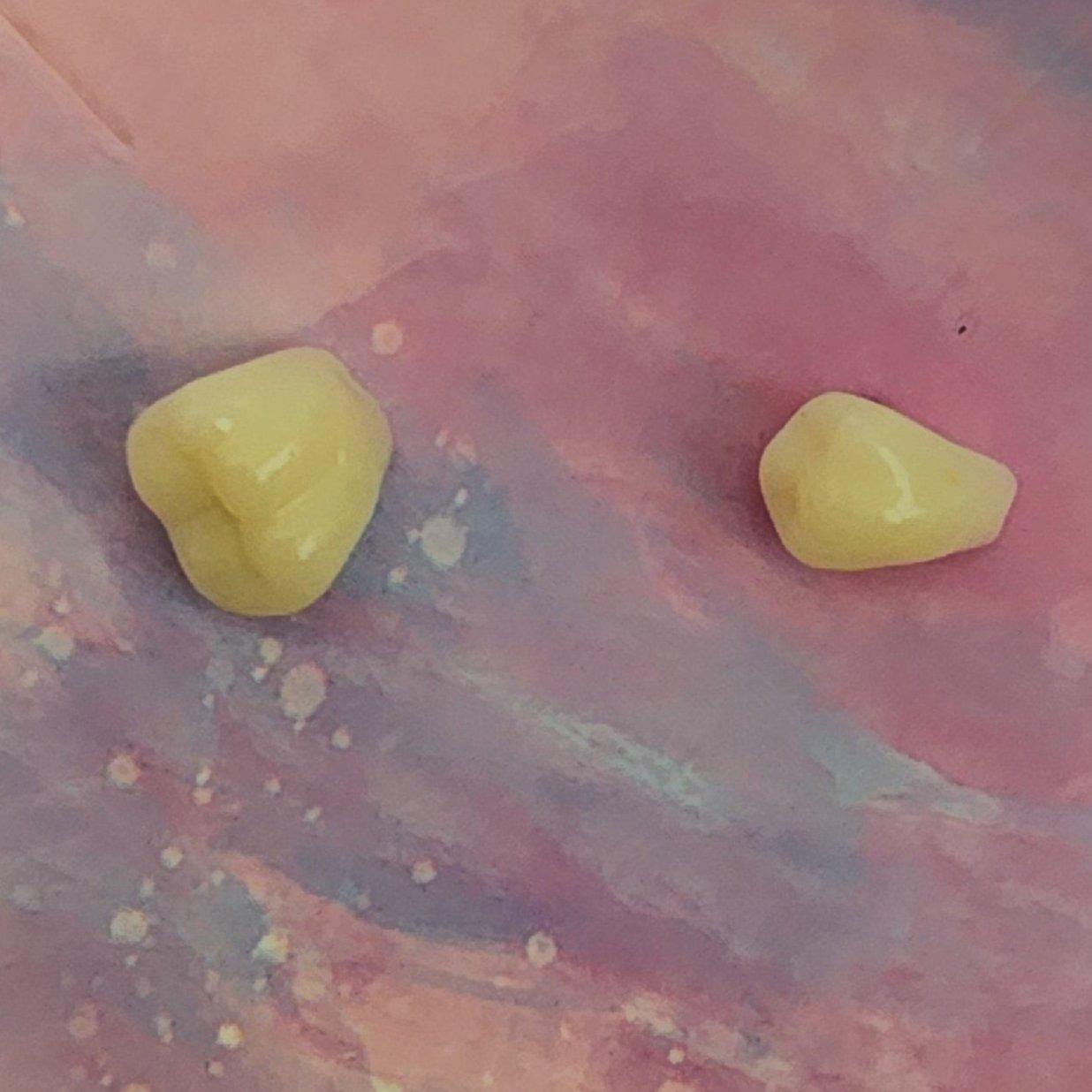 Resin Teeth Earrings